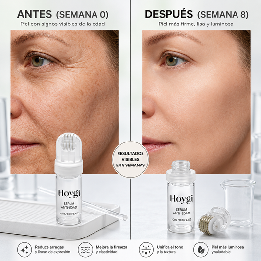 SET SÉRUM ANTIEDAD CON MICROAGUJAS 3X10ML. HOYGI MICRONEEDLING